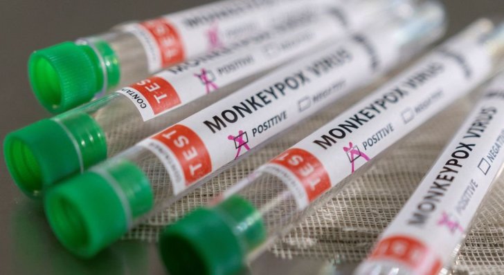Ministério confirma mais um caso de varíola dos macacos no país